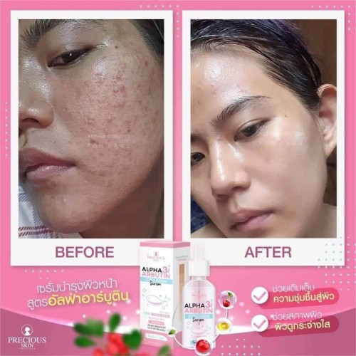 𝑨𝒍𝒑𝒉𝒂 𝒂𝒓𝒃𝒖𝒕𝒊𝒏 3 𝒑𝒍𝒖𝒔 𝒄𝒐𝒍𝒍𝒂𝒈𝒆𝒏 𝒔𝒆𝒓𝒖𝒎50mL , zozoj , mdnurunnabi