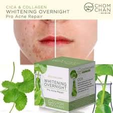 Cica Acne Whitening Cream, Bangladesh, zozoj , skincare