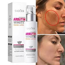 Sadoer Arbutin White Body Lotion (300g), হাত-পায়ের কালো দাগ দূর করার ক্রিম, সাদোর আরবুটিন বডি লোশন, রোদে পোড়া দাগ দূর করার উপায়, স্থায়ীভাবে ফর্সা হওয়ার বডি লোশন, zozoj